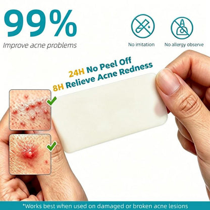 Dimora Medical-Grade Hydrocolloid Acne Patch Roll